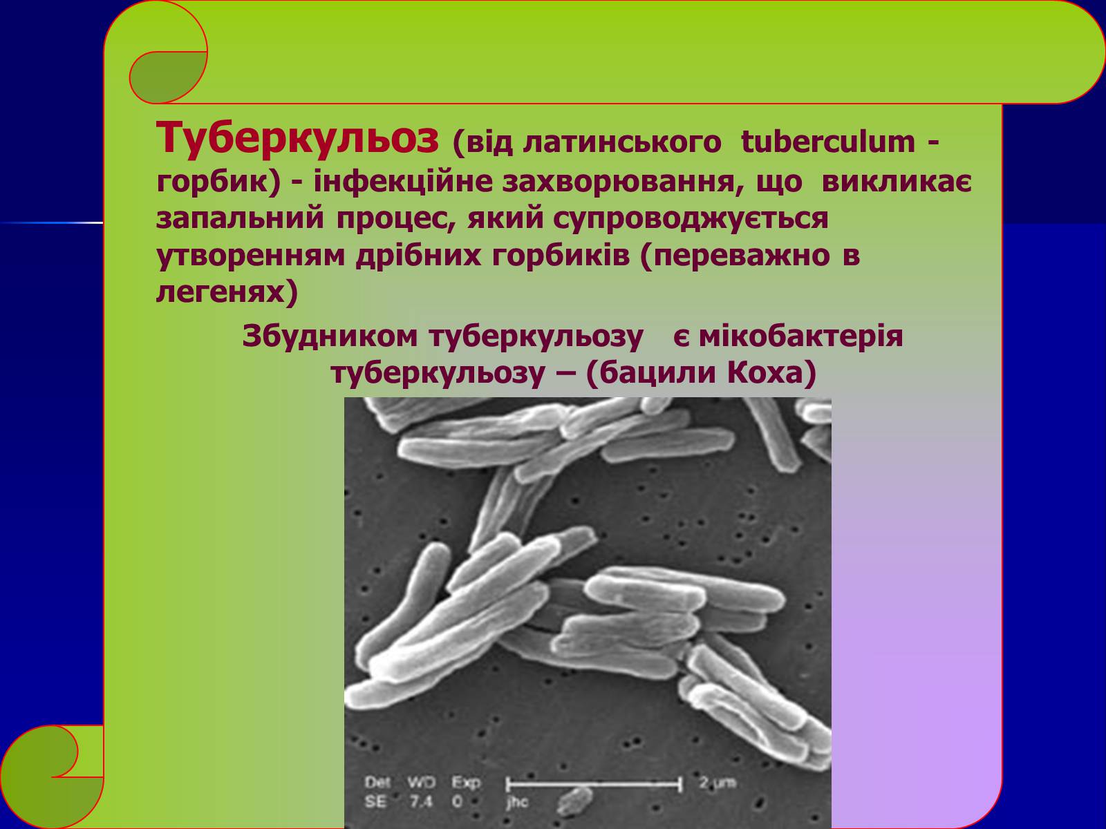 Презентація на тему «Інфекційні захворювання» (варіант 7) - Слайд #17