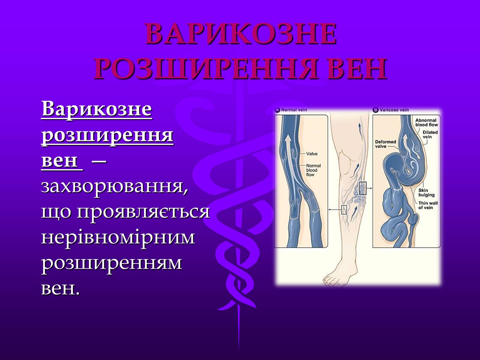 Презентація на тему «Хвороби серцево-судинної системи» (варіант 3) - Слайд #19