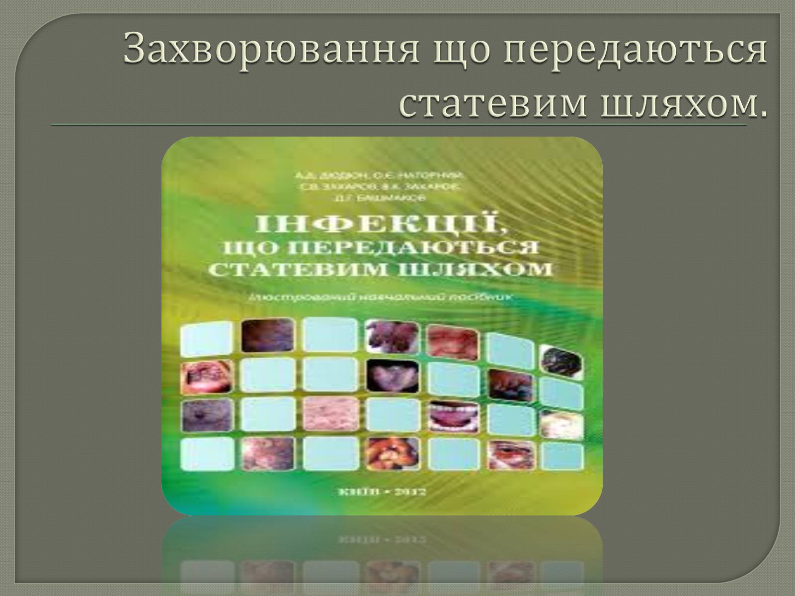 Презентація на тему «Захворювання що передаються статевим шляхом» - Слайд #1