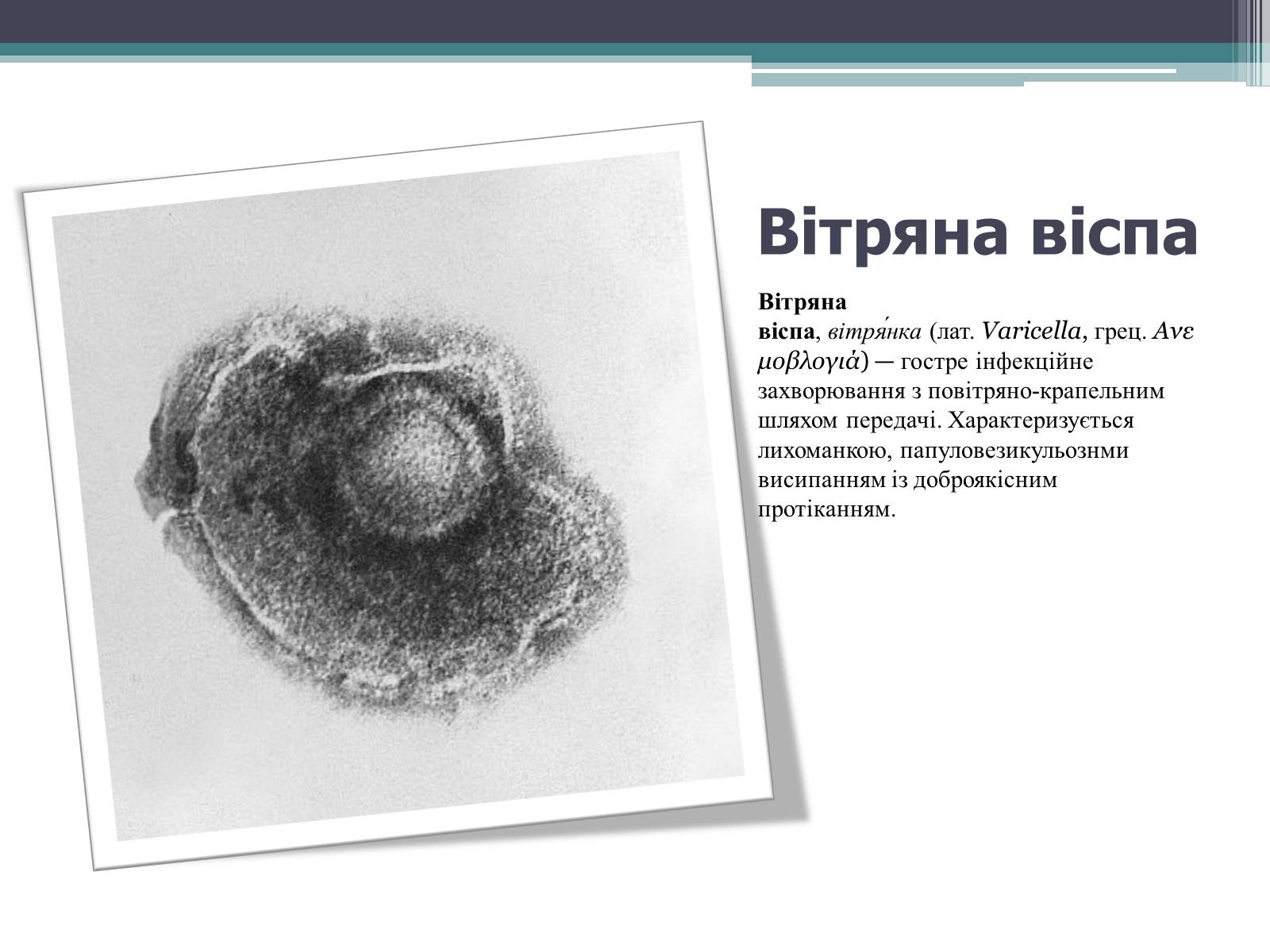 Презентація на тему «Дитячі інфекційні захворювання» - Слайд #15