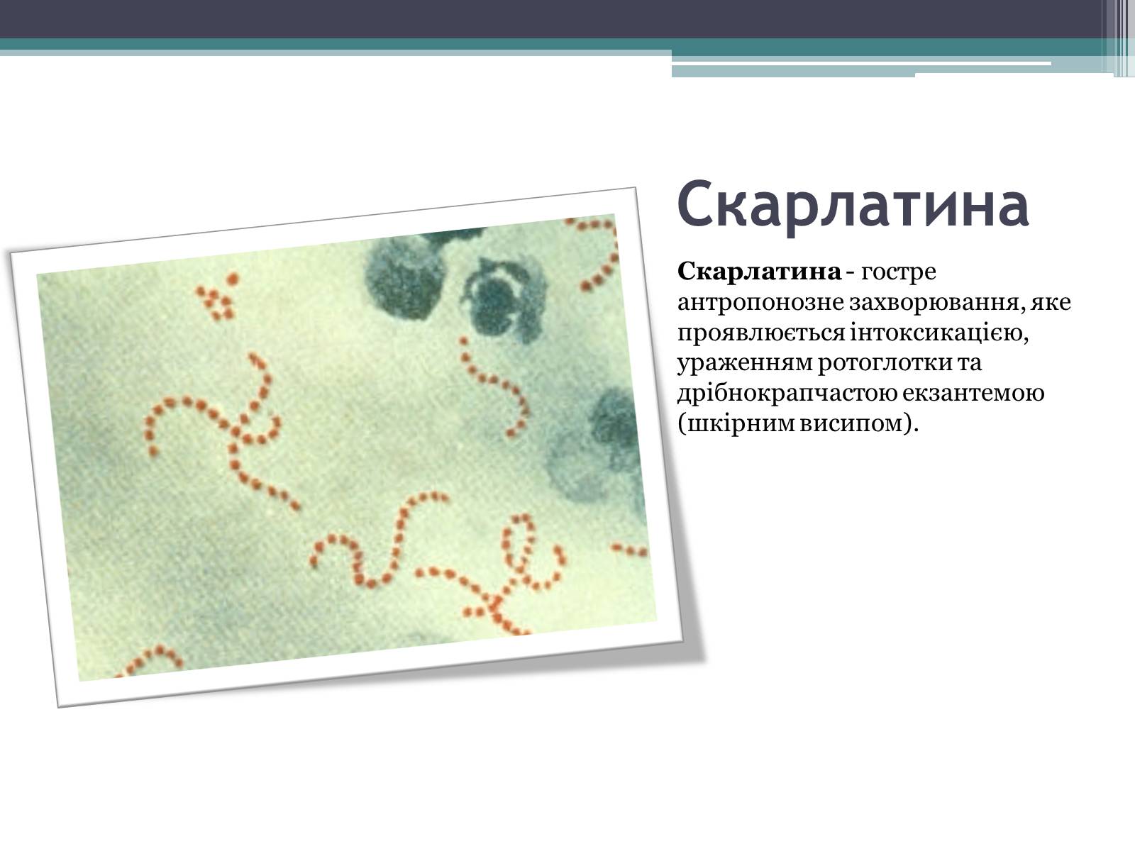 Презентація на тему «Дитячі інфекційні захворювання» - Слайд #5