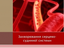 Презентація на тему «Захворювання серцево-судинної системи» (варіант 1)