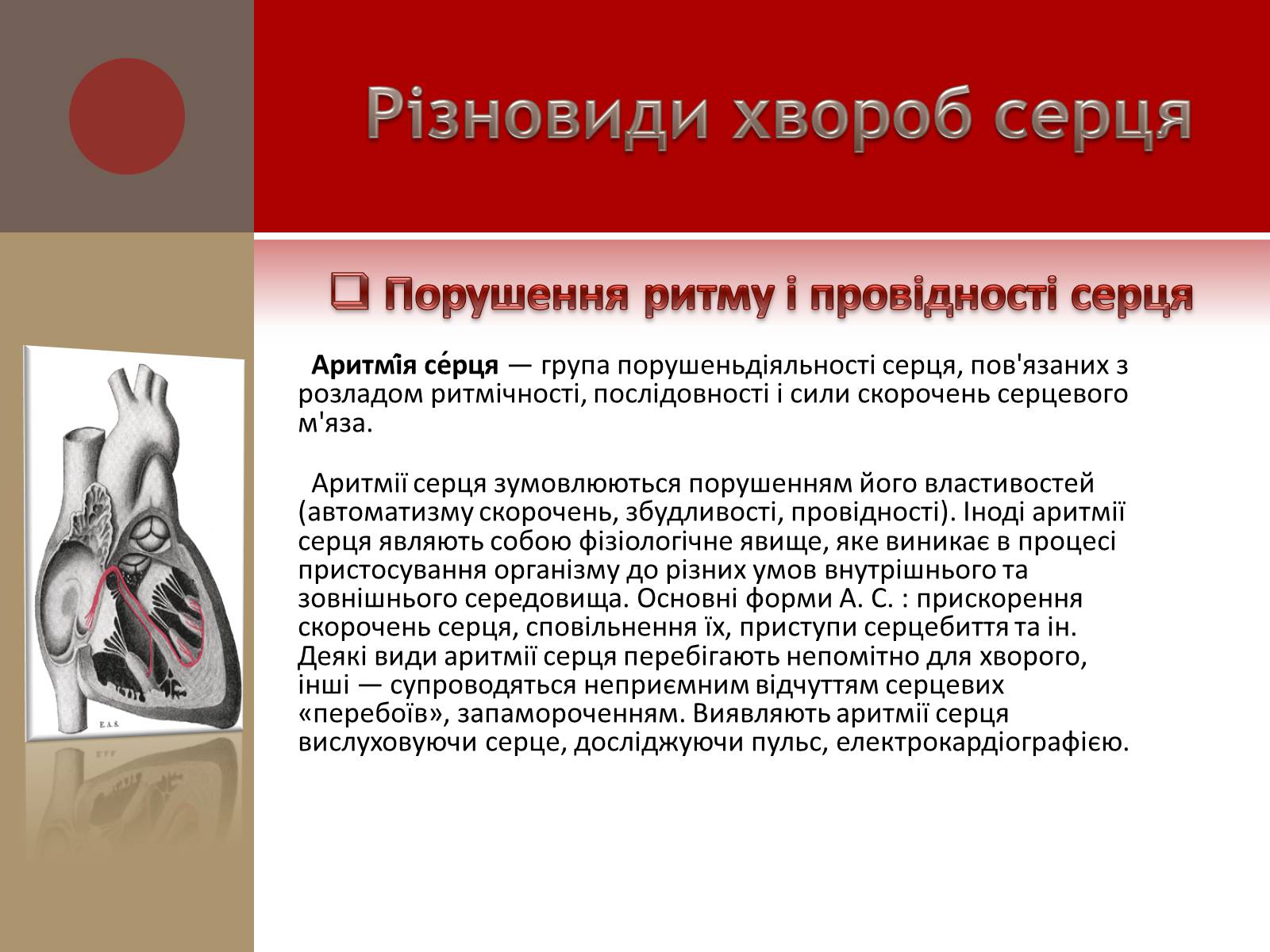 Презентація на тему «Захворювання серцево-судинної системи» (варіант 1) - Слайд #10