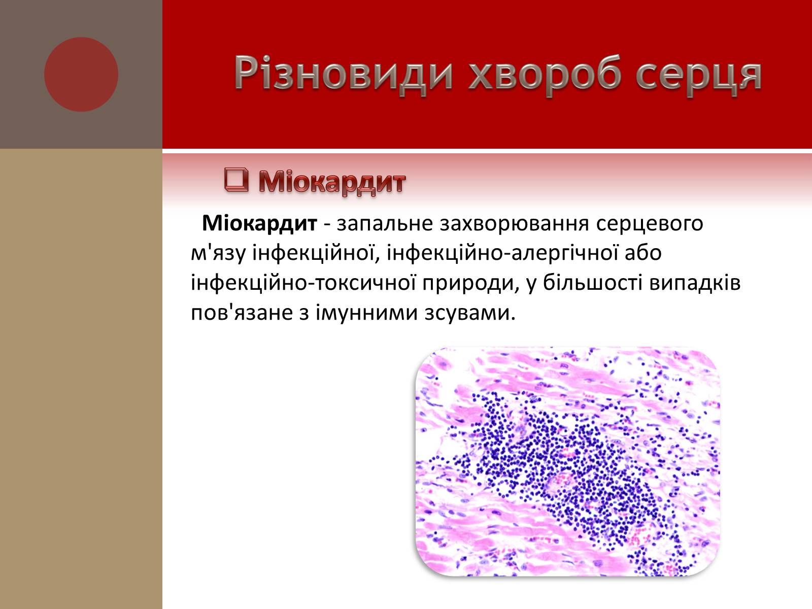 Презентація на тему «Захворювання серцево-судинної системи» (варіант 1) - Слайд #8