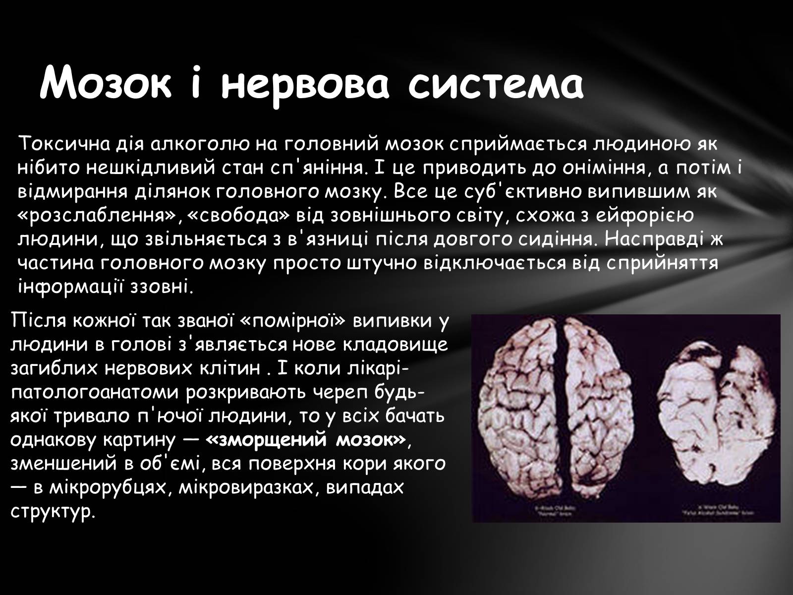 Презентація на тему «Шкідливий вплив алкоголю на організм» - Слайд #13