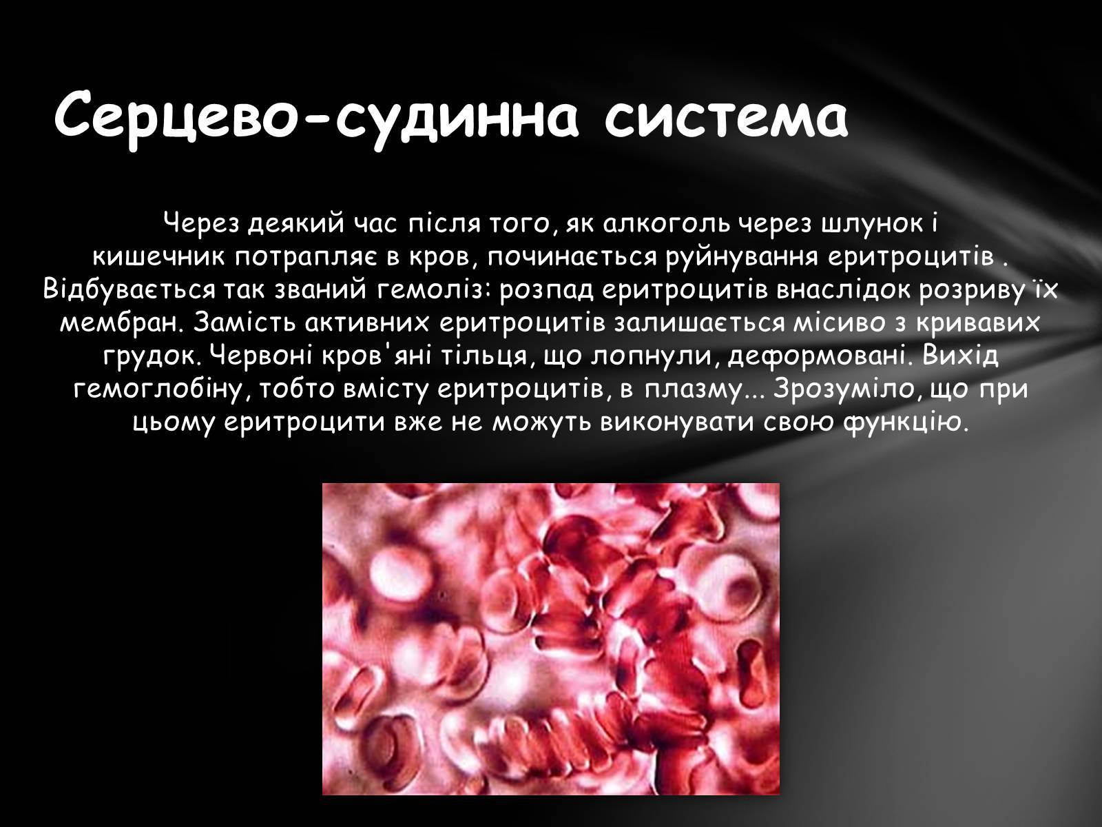 Презентація на тему «Шкідливий вплив алкоголю на організм» - Слайд #7