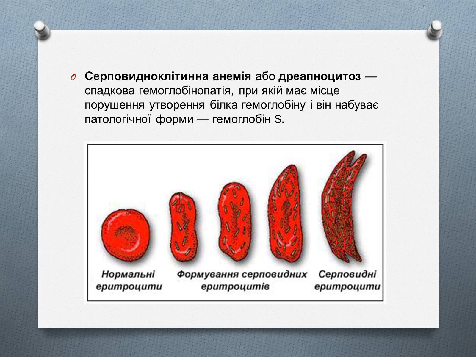 Презентація на тему «Генетичні хвороби» - Слайд #6