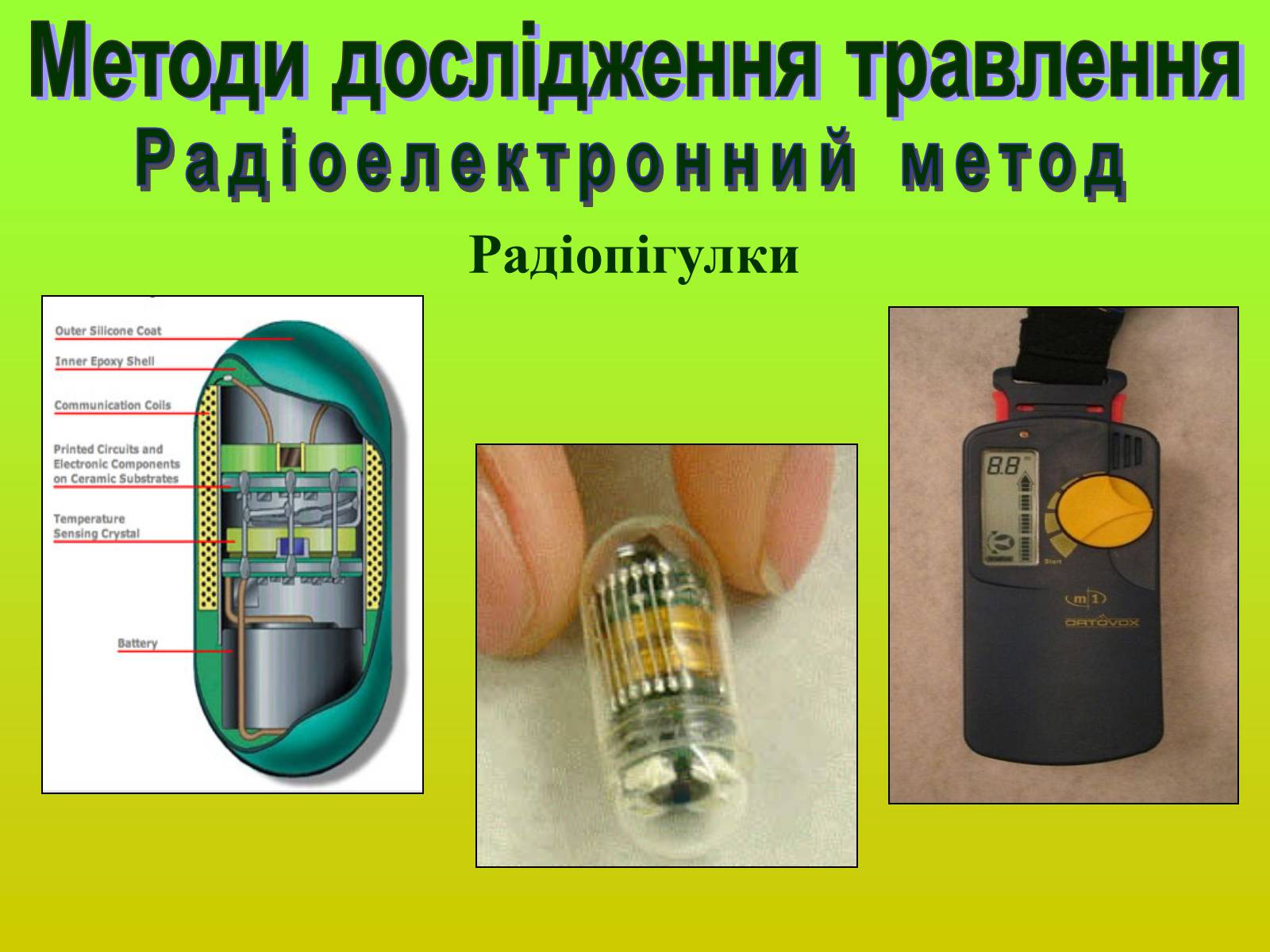 Презентація на тему «Методи дослідження органів травлення» - Слайд #10