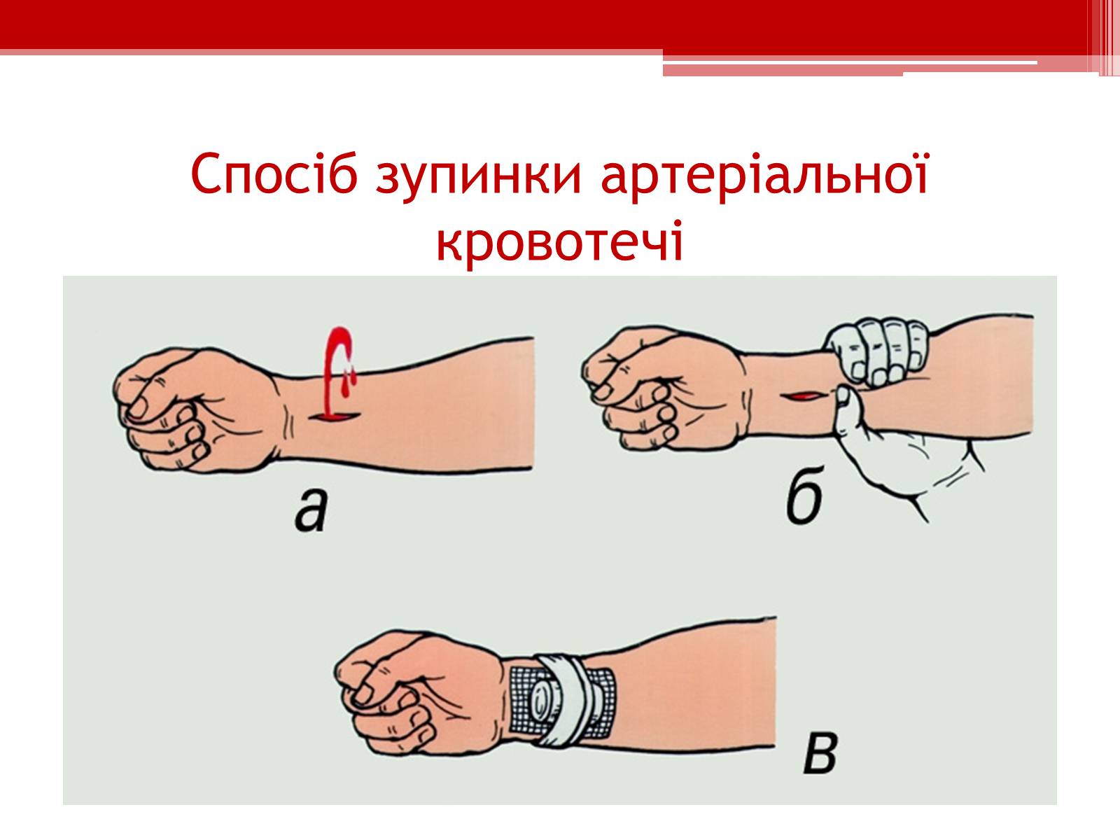 Презентація на тему «Перша допомога при кровотечах» (варіант 1) - Слайд #10