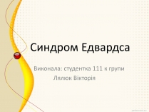 Презентація на тему «Синдром Эдвардса»