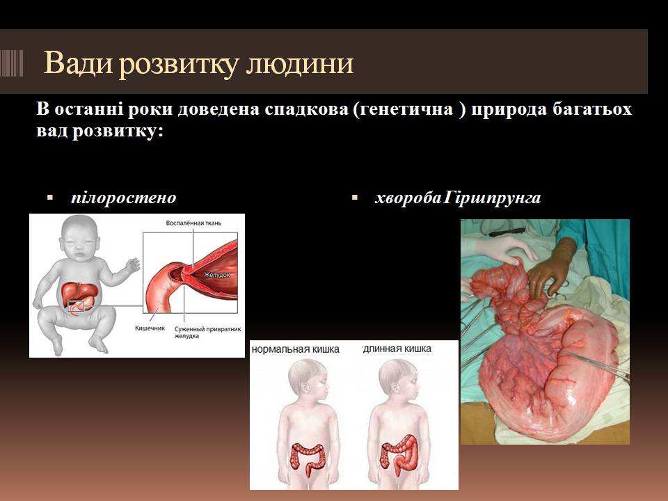 Презентація на тему «Гомеостаз ембріонального розвитку» - Слайд #10