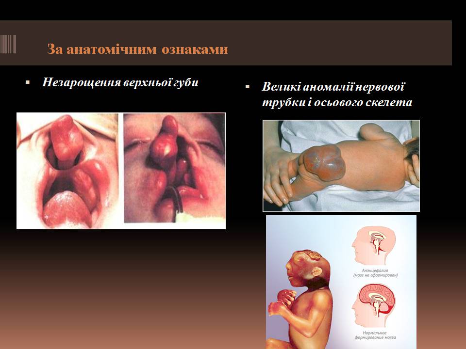 Презентація на тему «Гомеостаз ембріонального розвитку» - Слайд #13