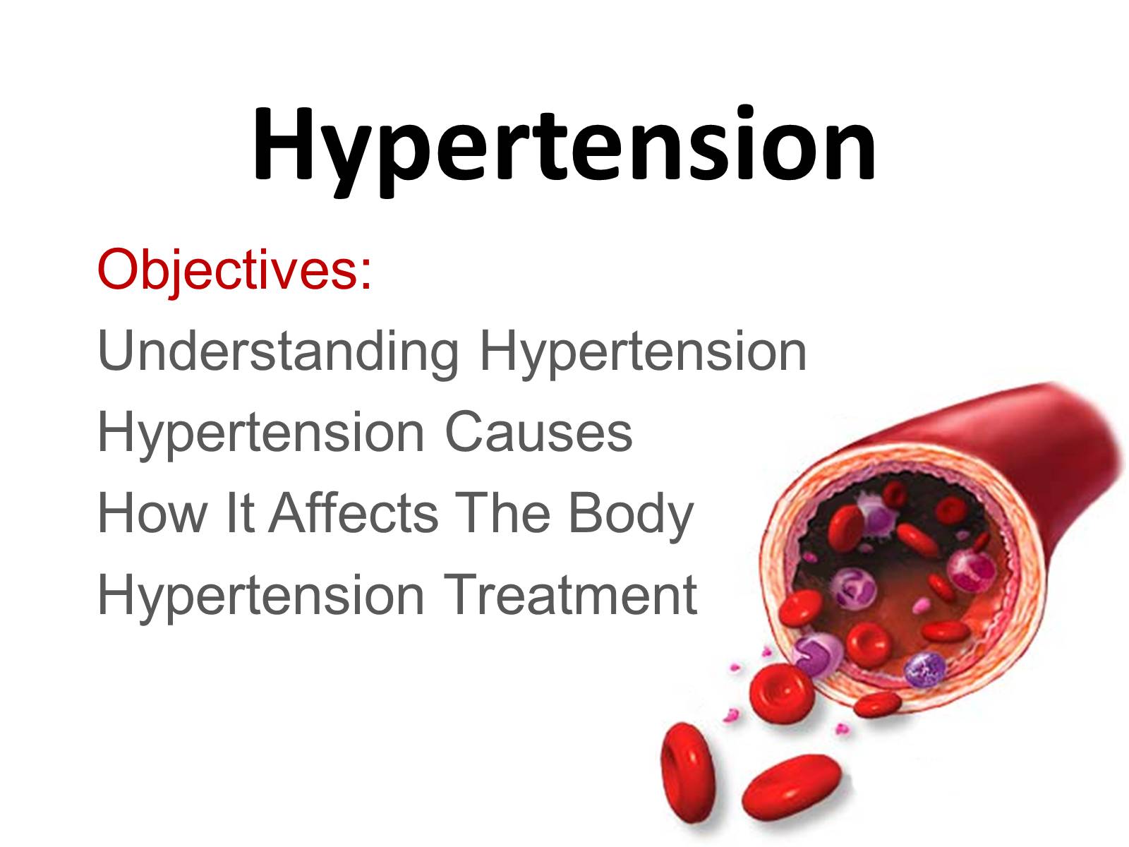 Презентація на тему «Hypertension» - Слайд #1