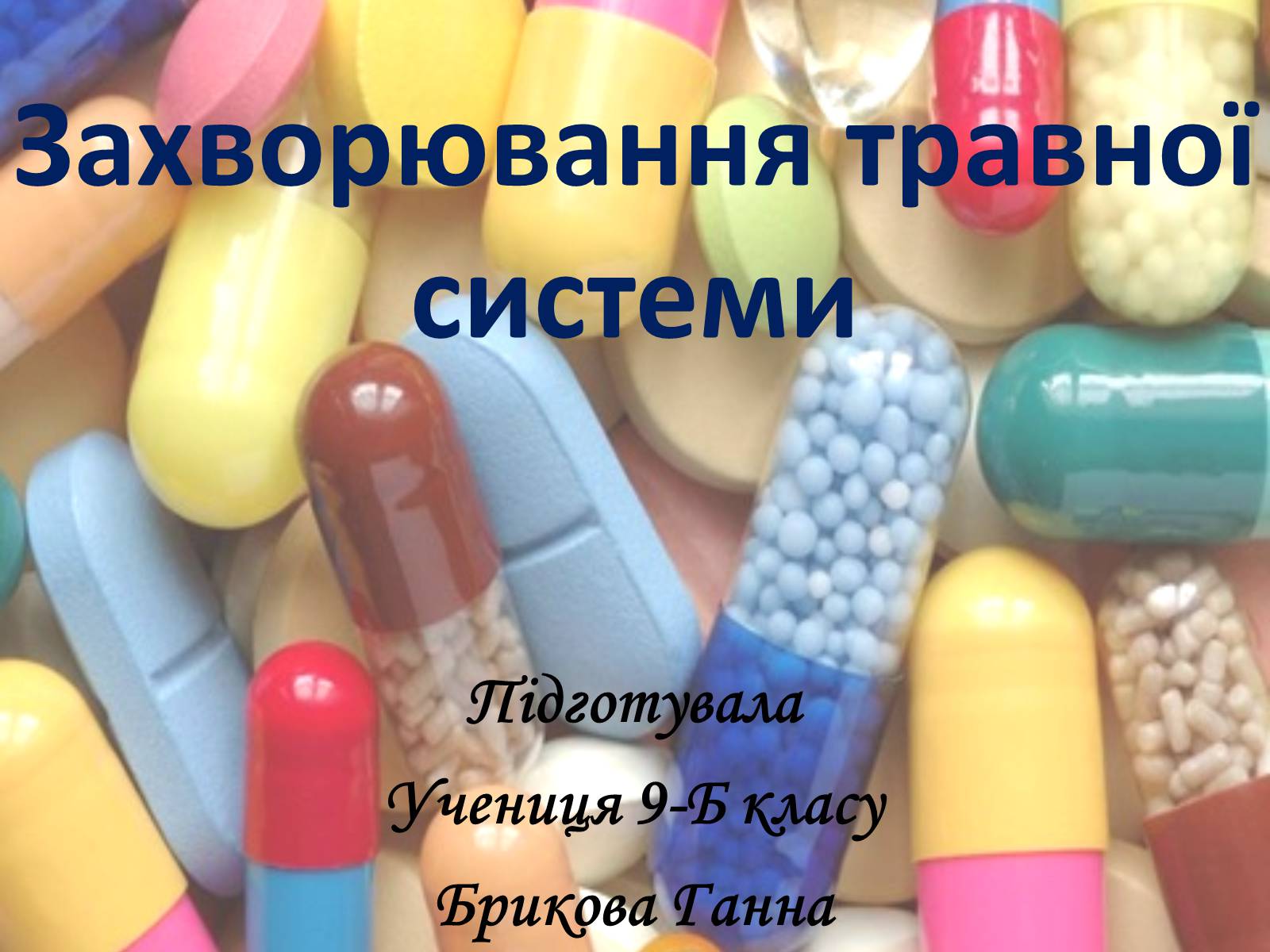 Презентація на тему «Захворювання травної системи» (варіант 1) - Слайд #1