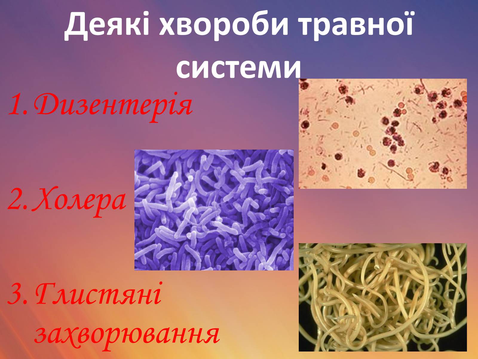 Презентація на тему «Захворювання травної системи» (варіант 1) - Слайд #6