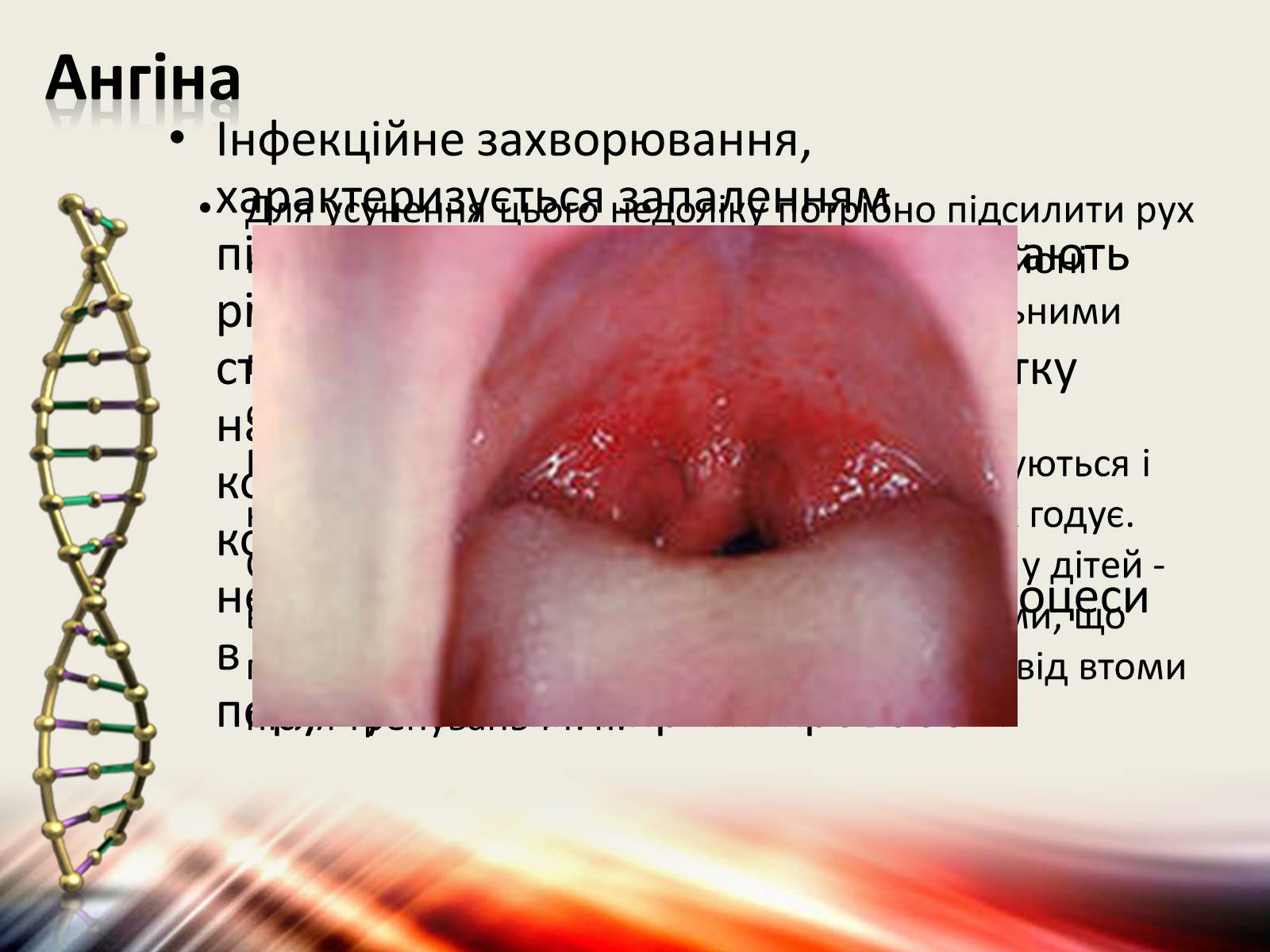 Презентація на тему «Захворювання дихальної системи» (варіант 1) - Слайд #6