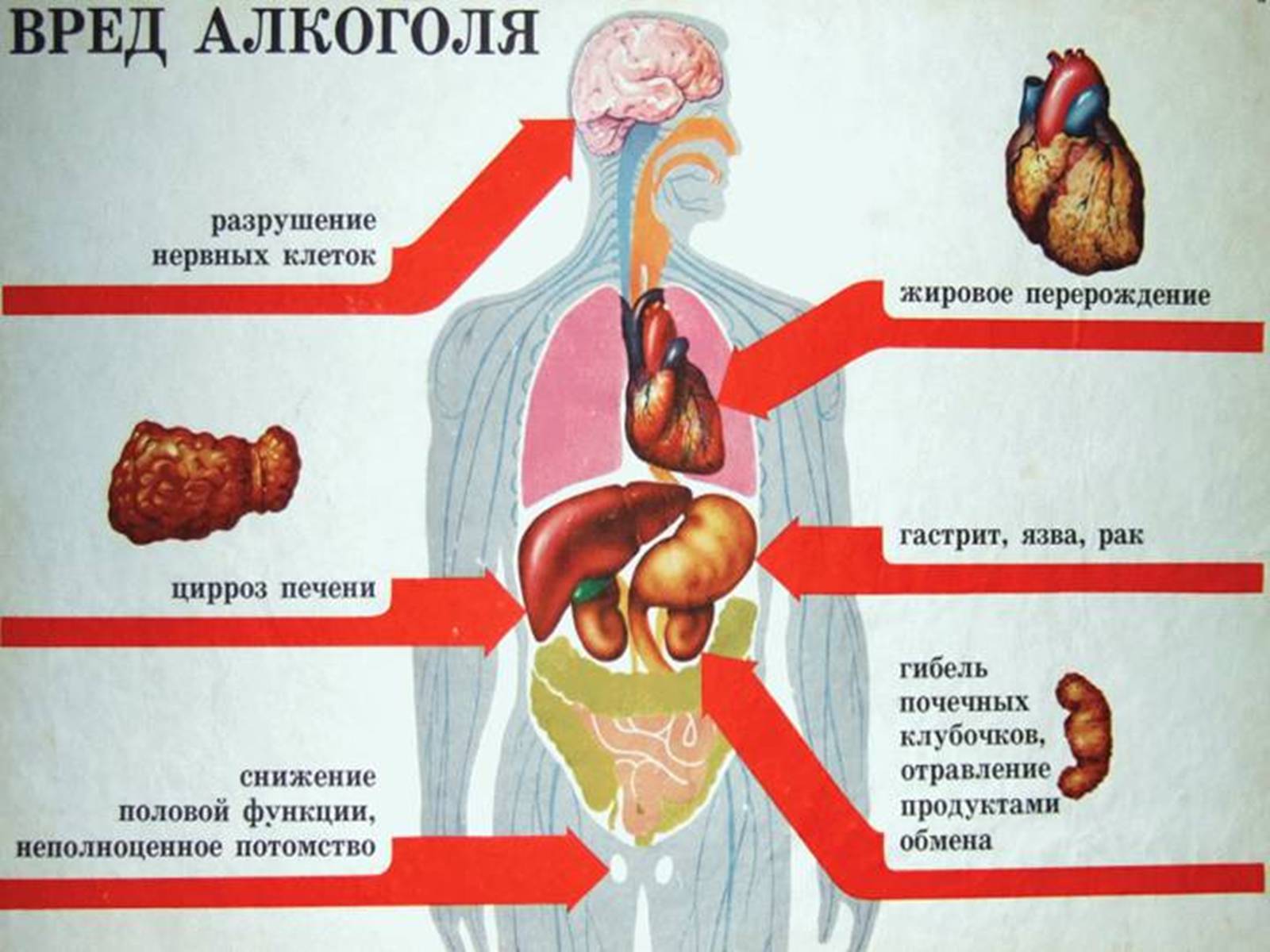 Презентація на тему «Влияние алкоголя на беременную женщину» - Слайд #6