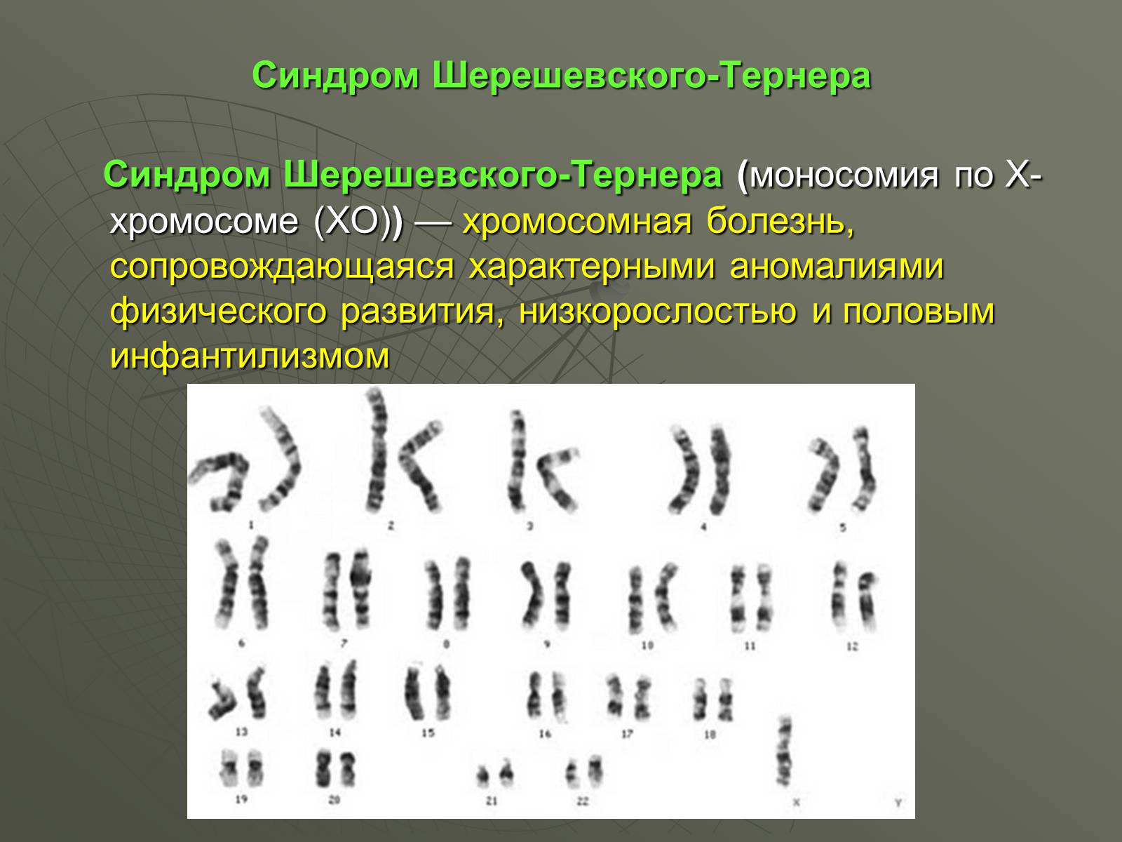 Презентація на тему «Генетические заболевания человека» - Слайд #6