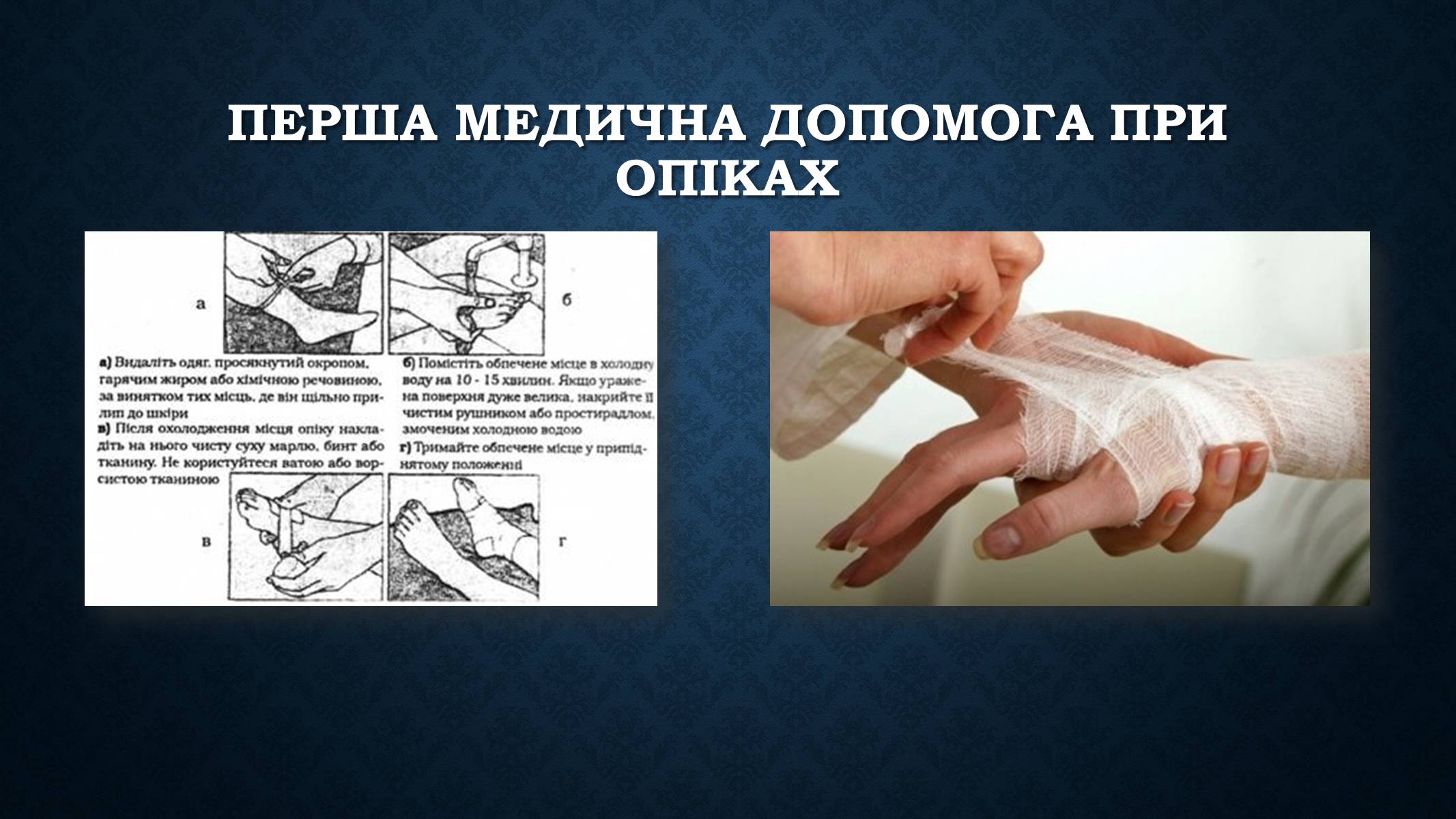 Презентація на тему «Опіки та отруєння організму людини» - Слайд #10