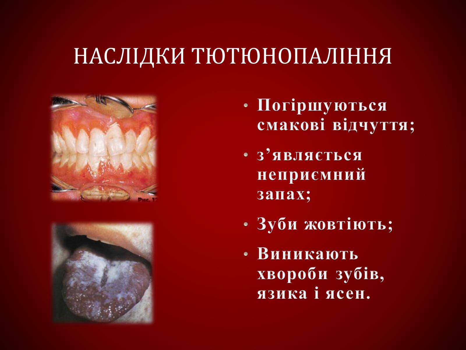 Презентація на тему «Шкідливий вплив тютюнопаління» (варіант 1) - Слайд #20