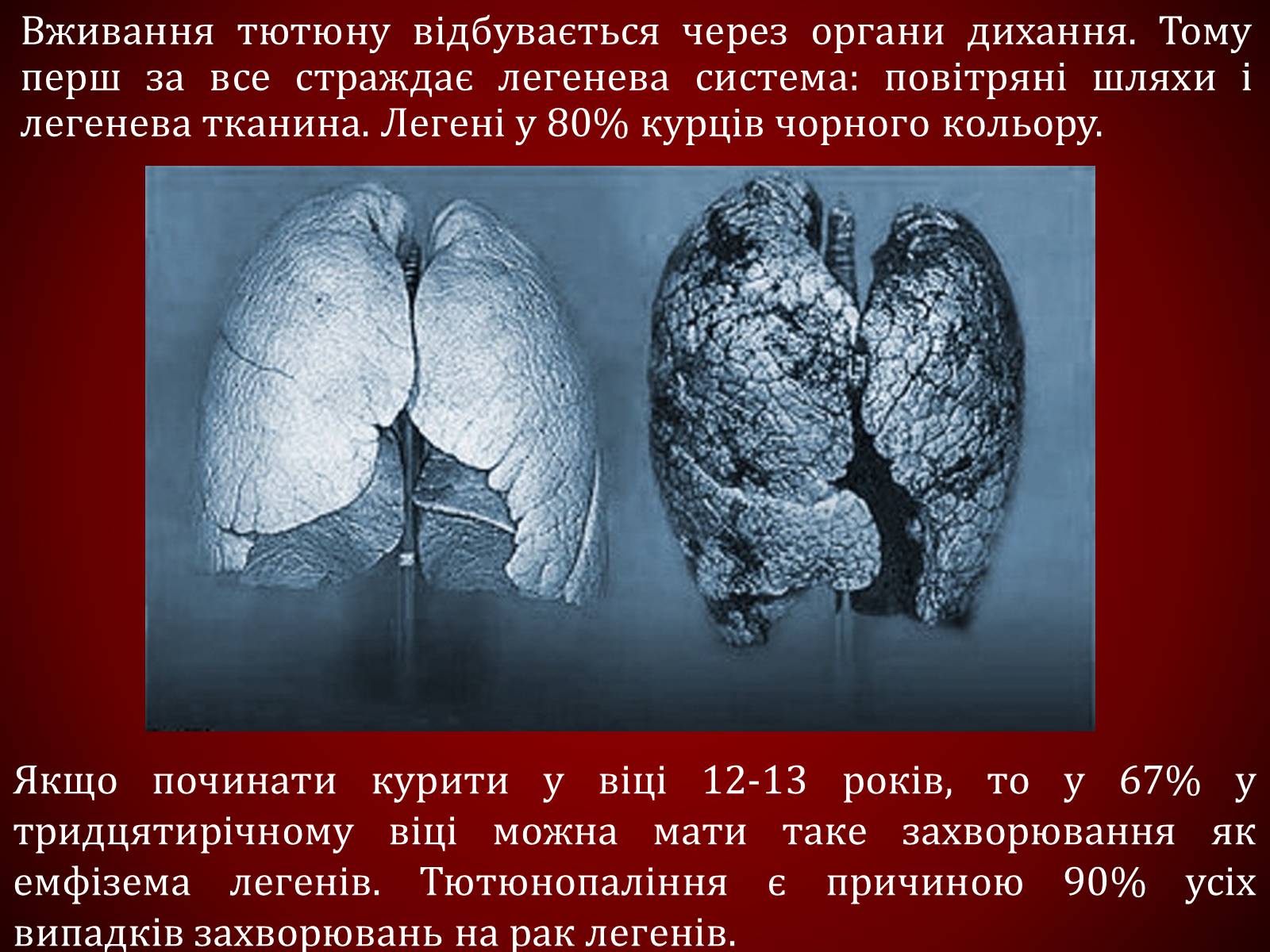 Презентація на тему «Шкідливий вплив тютюнопаління» (варіант 1) - Слайд #23