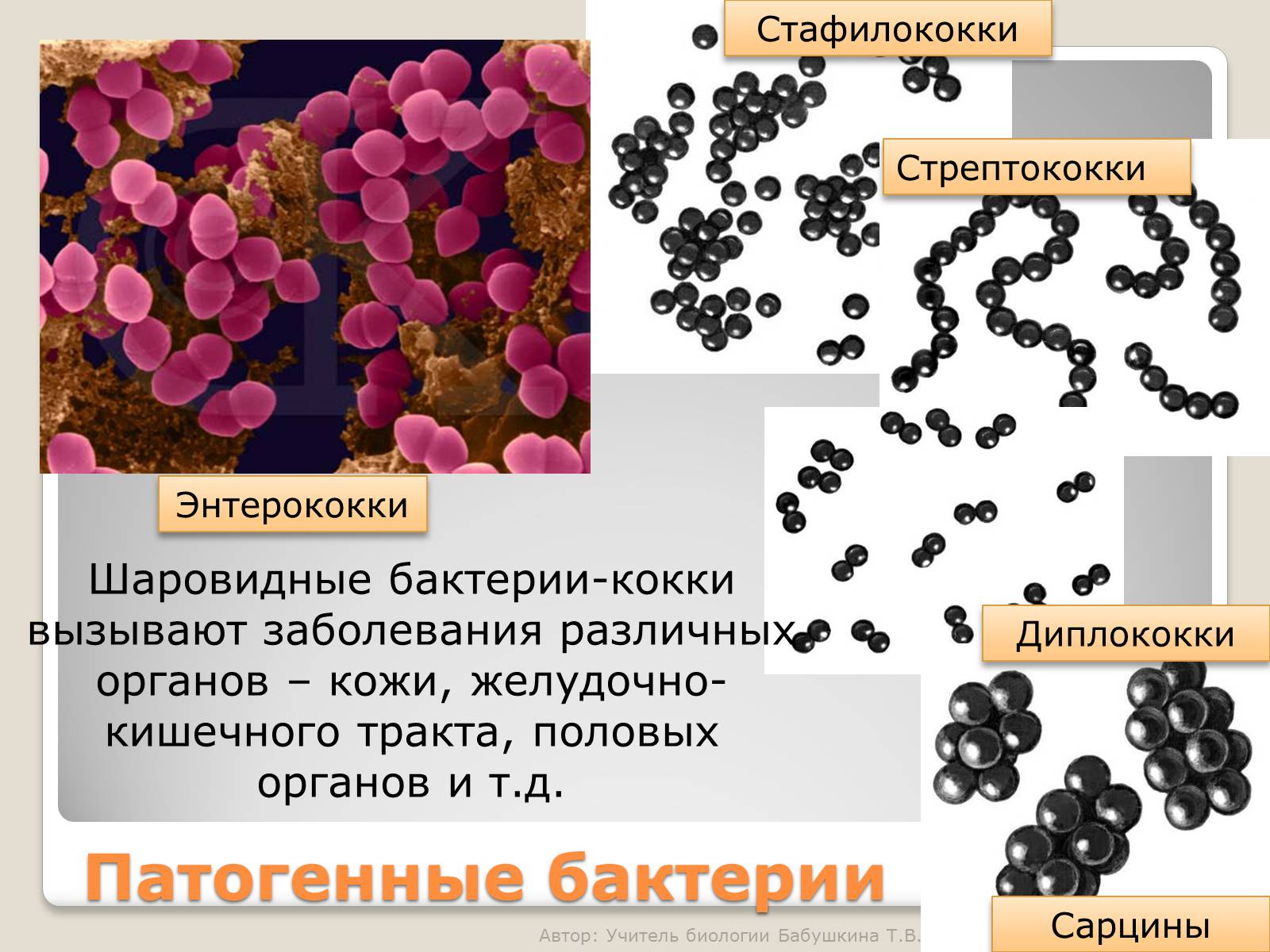 Кокковые бактерии. Шаровидные бактерии сарцины. Шарообразные кокки бактерии. Кокками (стафилококки, стрептококки, сарцины). Стрептококки диплококки стафилококки.