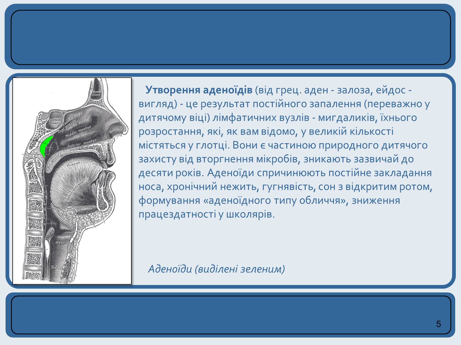 Презентація на тему «Хвороби органів дихання та їх профілактика» (варіант 2) - Слайд #5