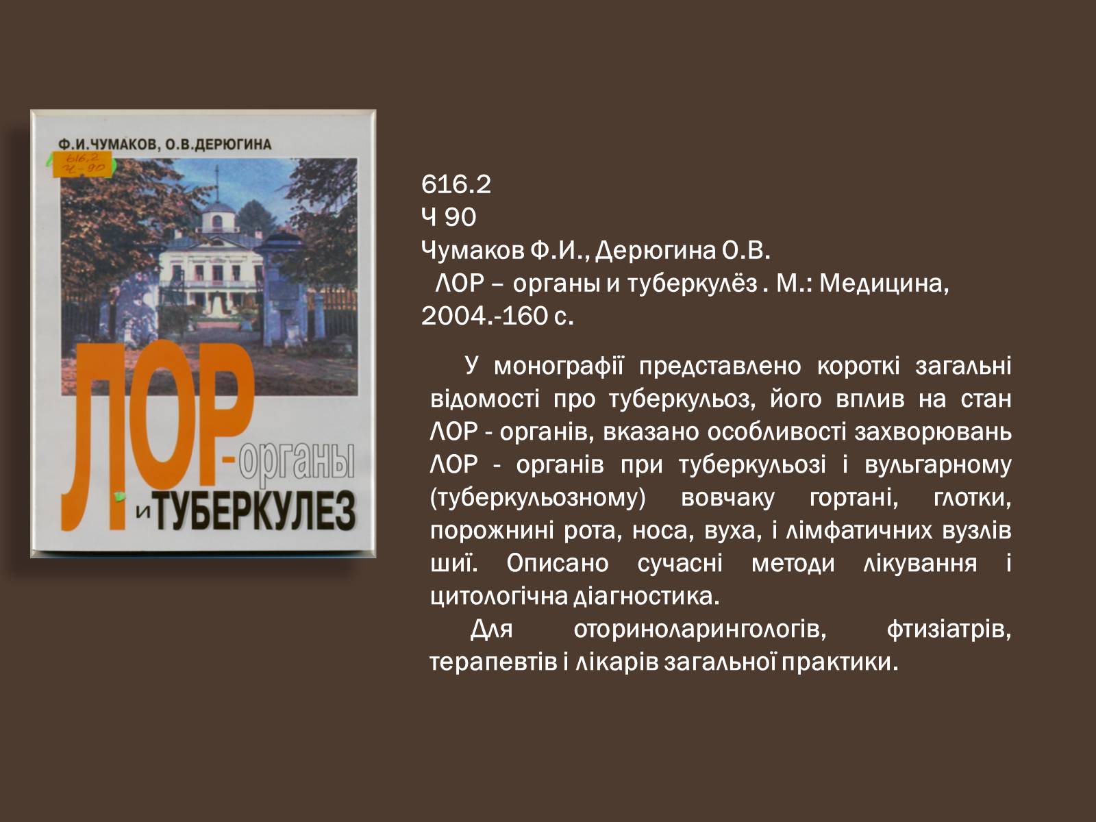 Презентація на тему «Туберкульоз. Сучасні методи діагностики та лікування» - Слайд #12