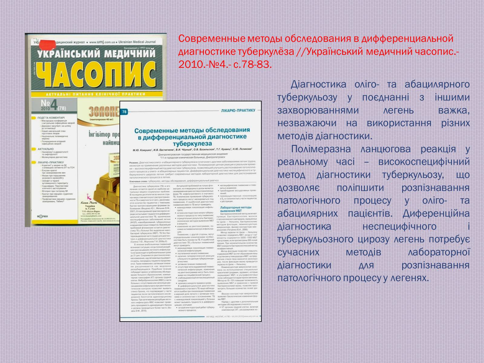 Презентація на тему «Туберкульоз. Сучасні методи діагностики та лікування» - Слайд #13