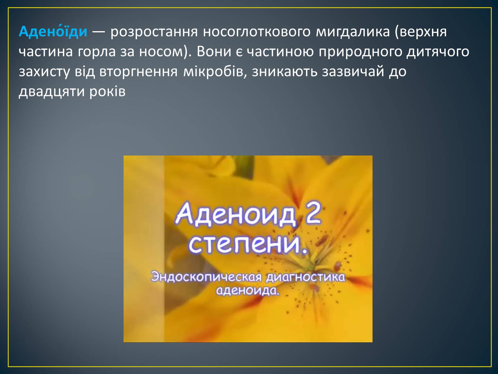 Презентація на тему «Захворювання органів дихання» - Слайд #8