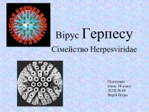 Презентація на тему «Вірус Герпесу»