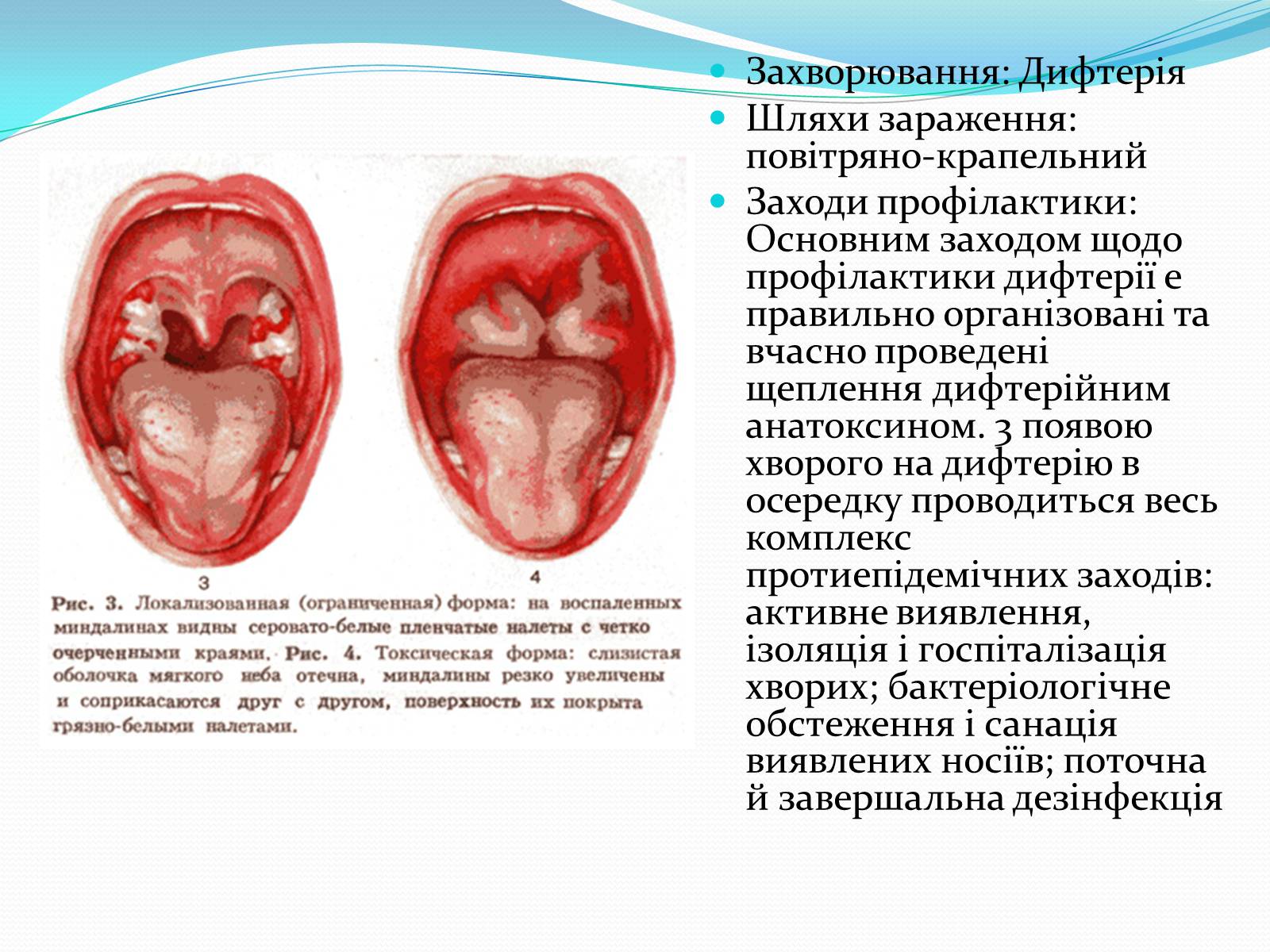 Презентація на тему «Профілактика бактеріальних захворювань людини» - Слайд #6