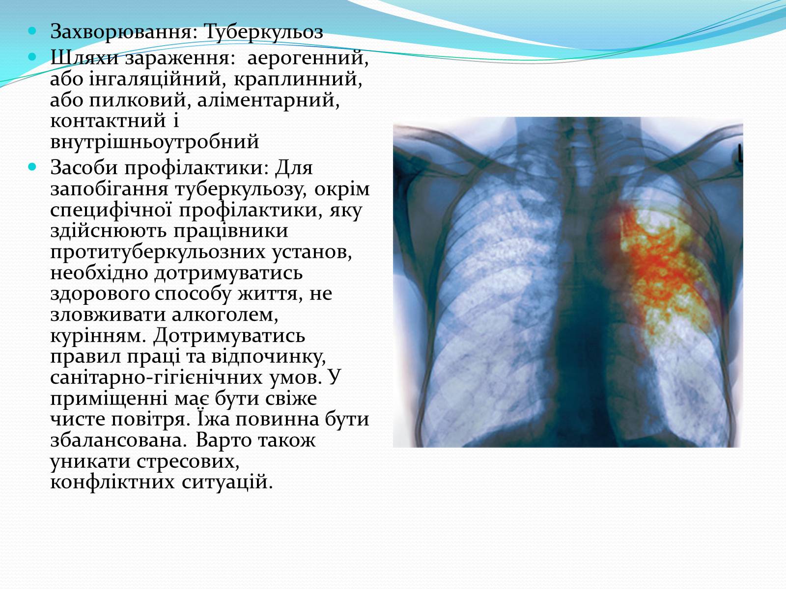 Презентація на тему «Профілактика бактеріальних захворювань людини» - Слайд #9