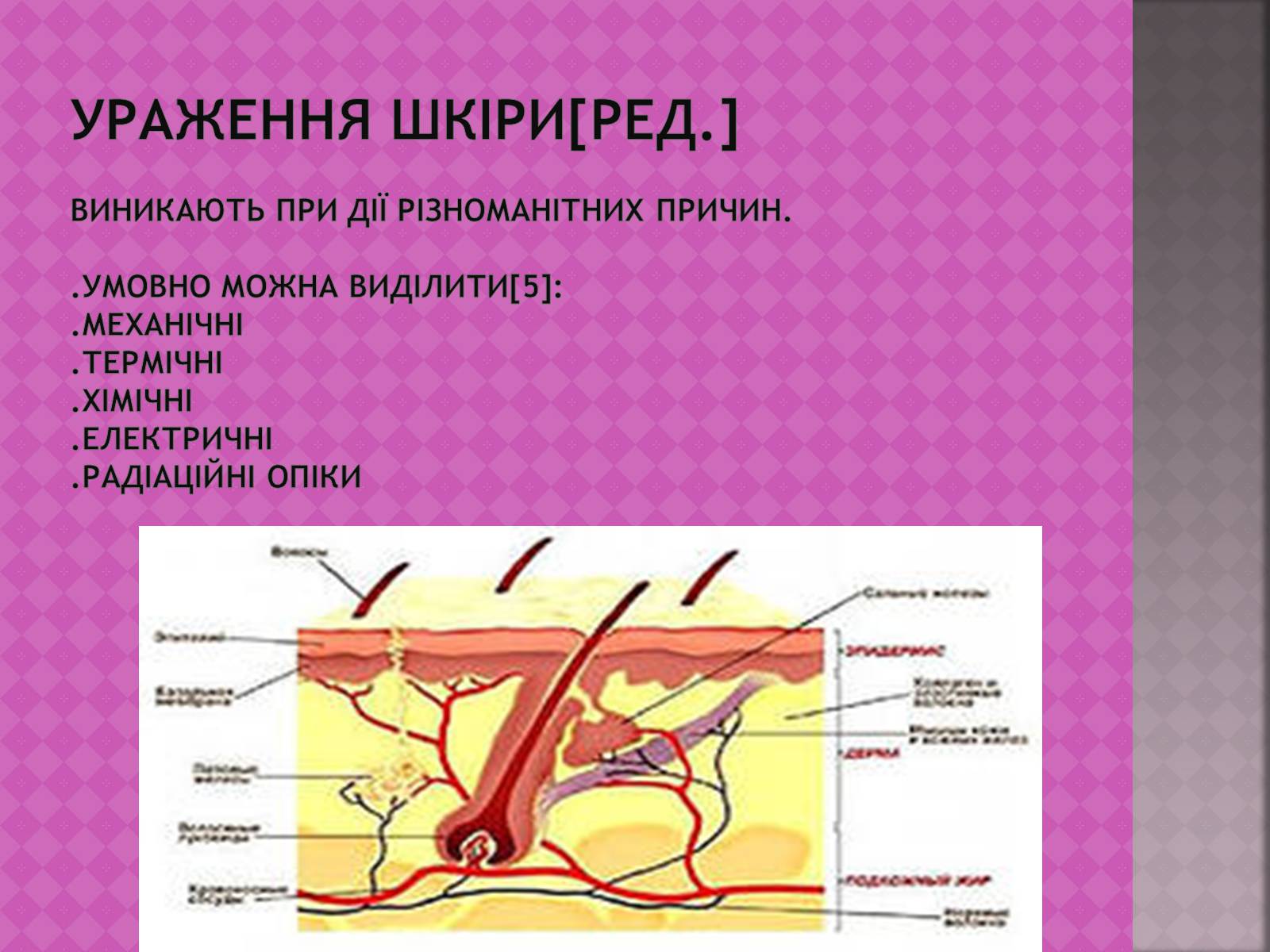 Презентація на тему «Шкіра, та її хвороби» - Слайд #6