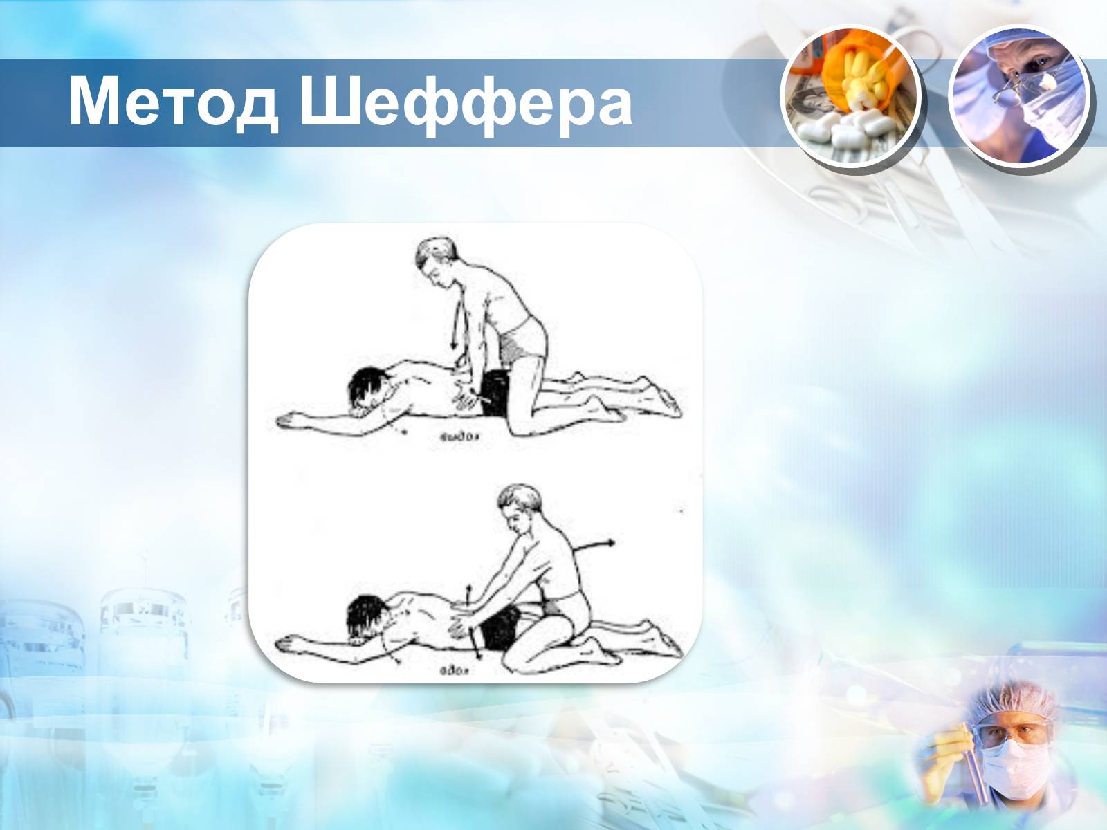 Презентація на тему «Методика проведення штучного дихання і закритого масажу серця» - Слайд #8