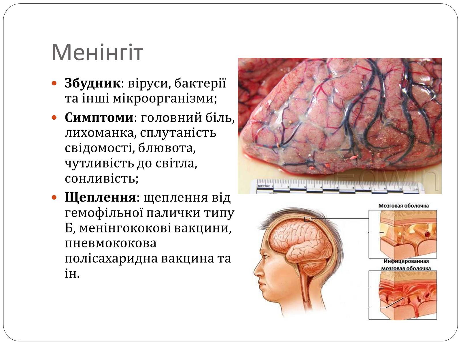 Презентація на тему «Інфекційні захворювання» (варіант 3) - Слайд #6