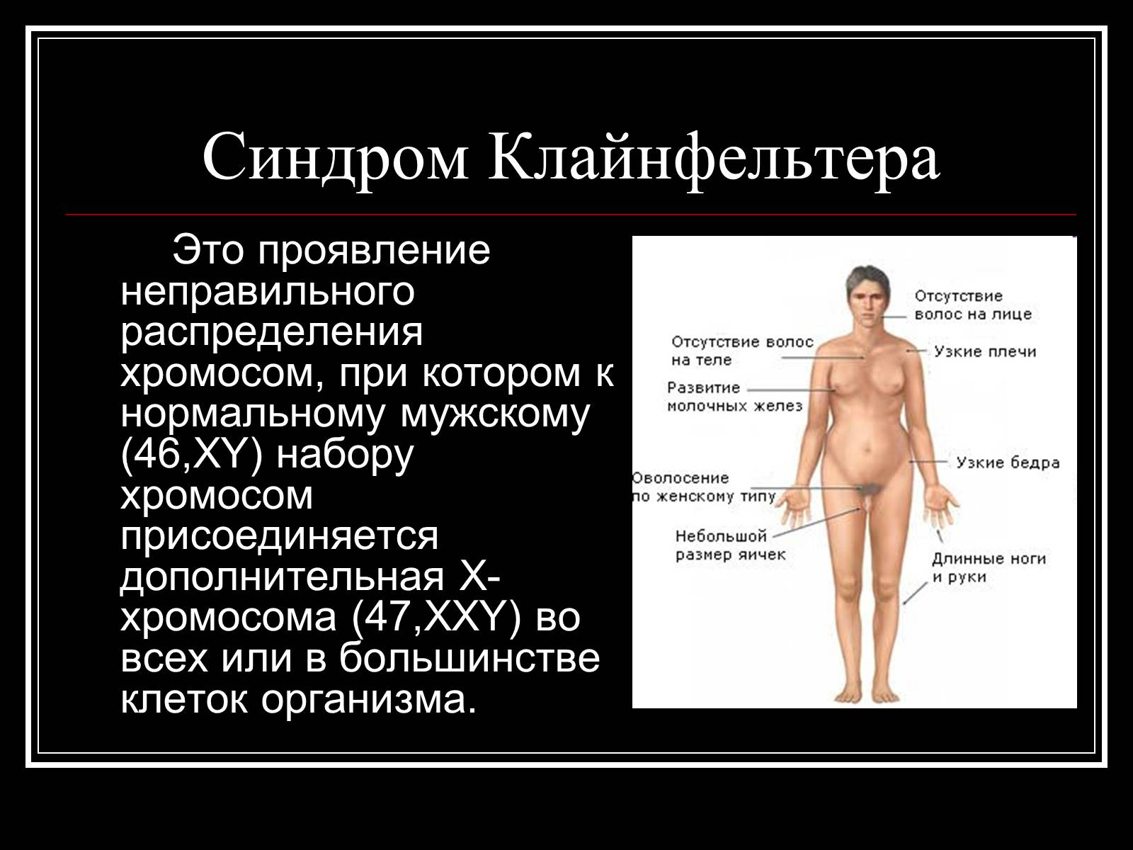 Презентація на тему «Генетика человека» (варіант 1) - Слайд #16