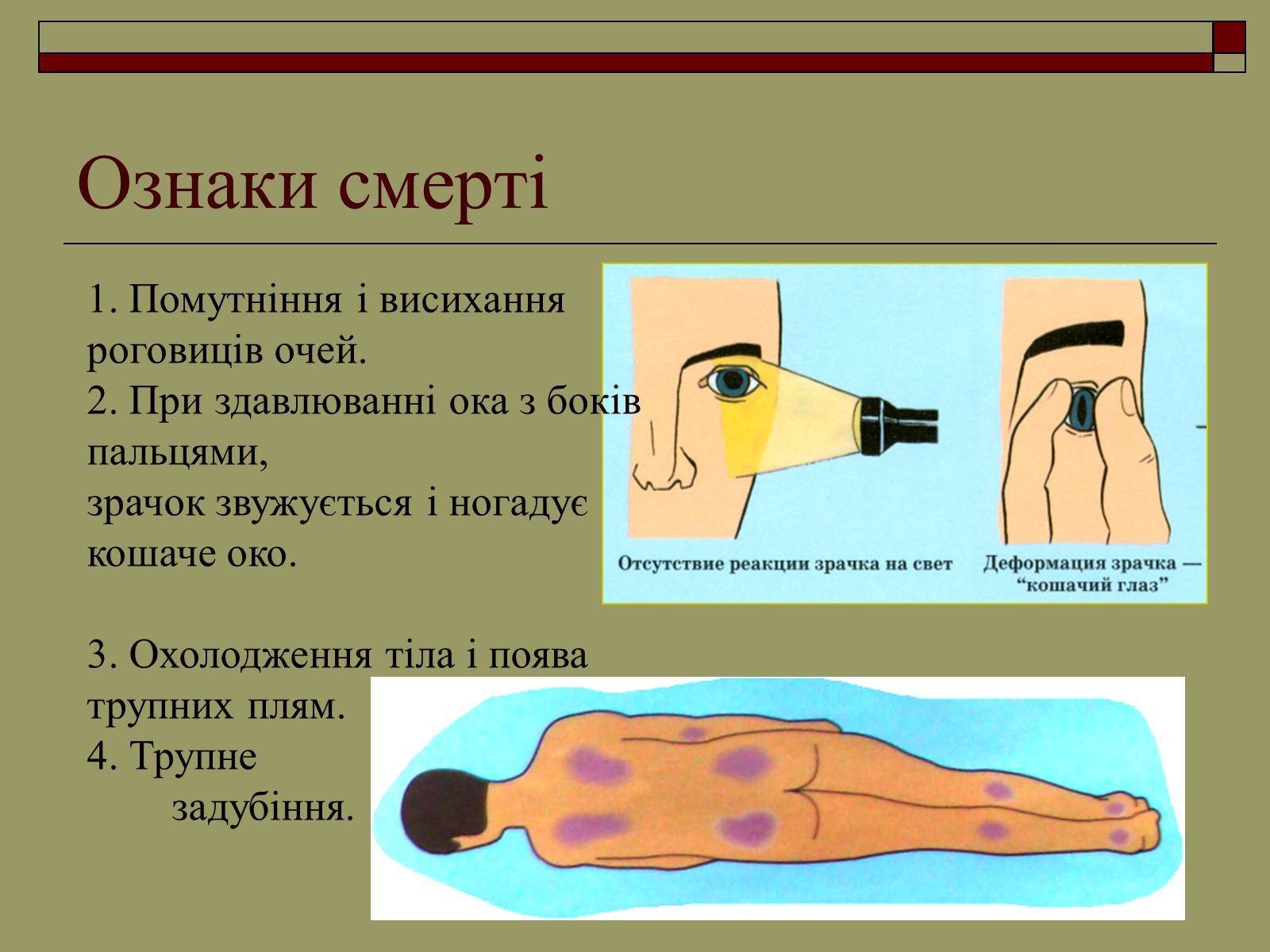 Презентація на тему «Перша медична допомога» (варіант 2) - Слайд #6