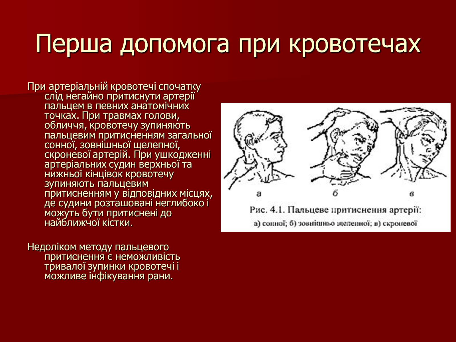 Презентація на тему «Кровотечі, їх класифікація» - Слайд #9