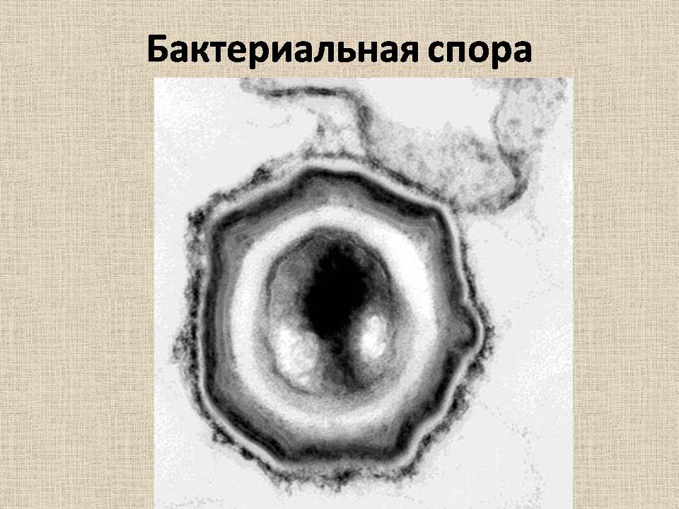 Презентація на тему «Прокариоты» (варіант 4) - Слайд #15