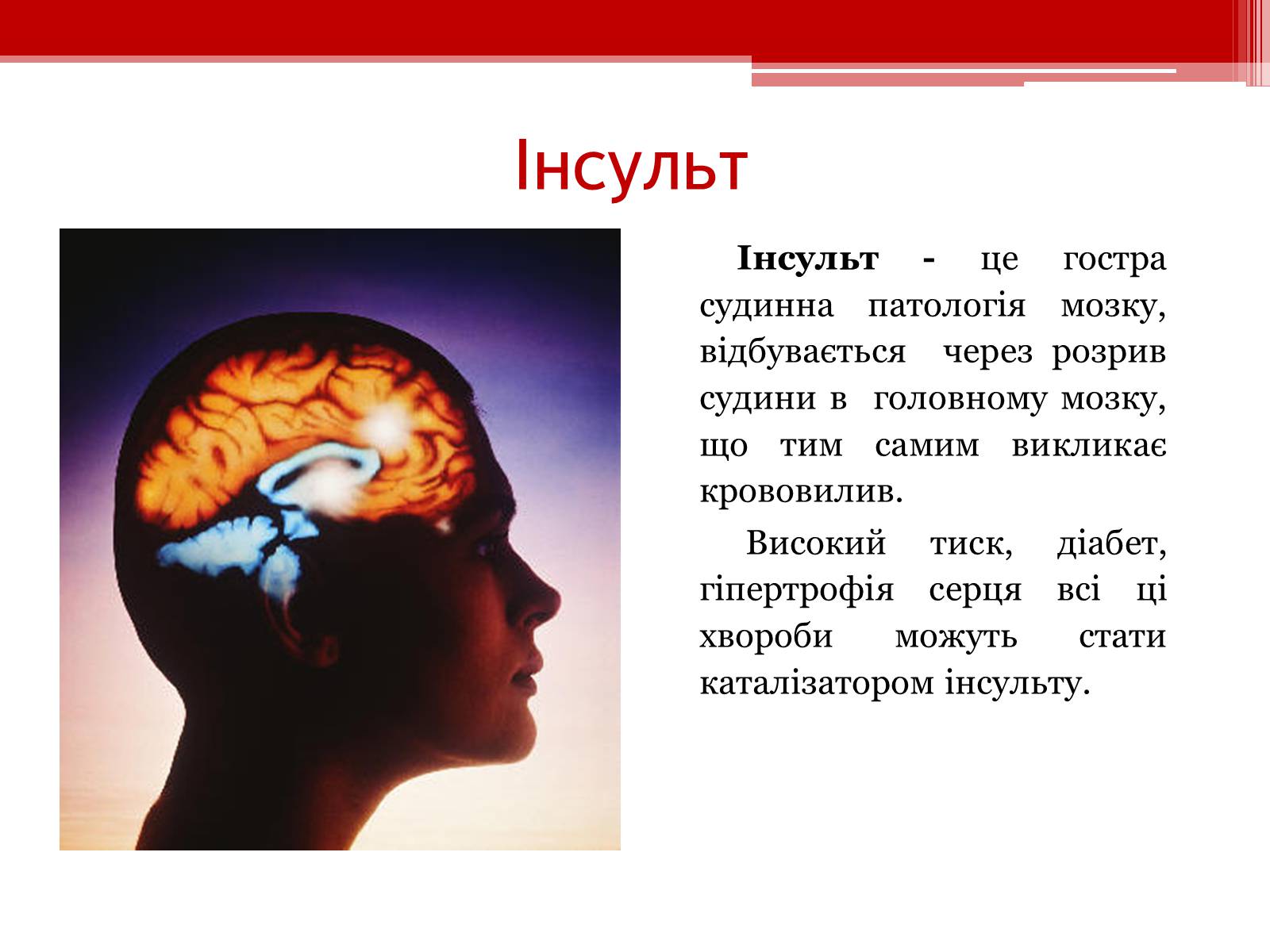 Презентація на тему «Захворювання серцево – судинної системи. Профілактика» - Слайд #9