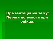 Презентація на тему «Перша допомога при опіках» (варіант 2)