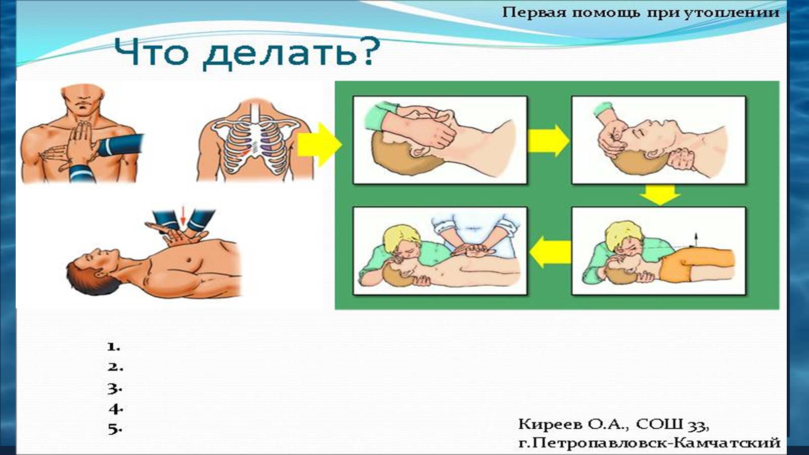 Презентація на тему «Надання першої допомоги при утопленні» - Слайд #10