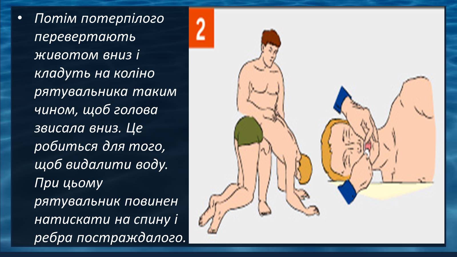 Презентація на тему «Надання першої допомоги при утопленні» - Слайд #7