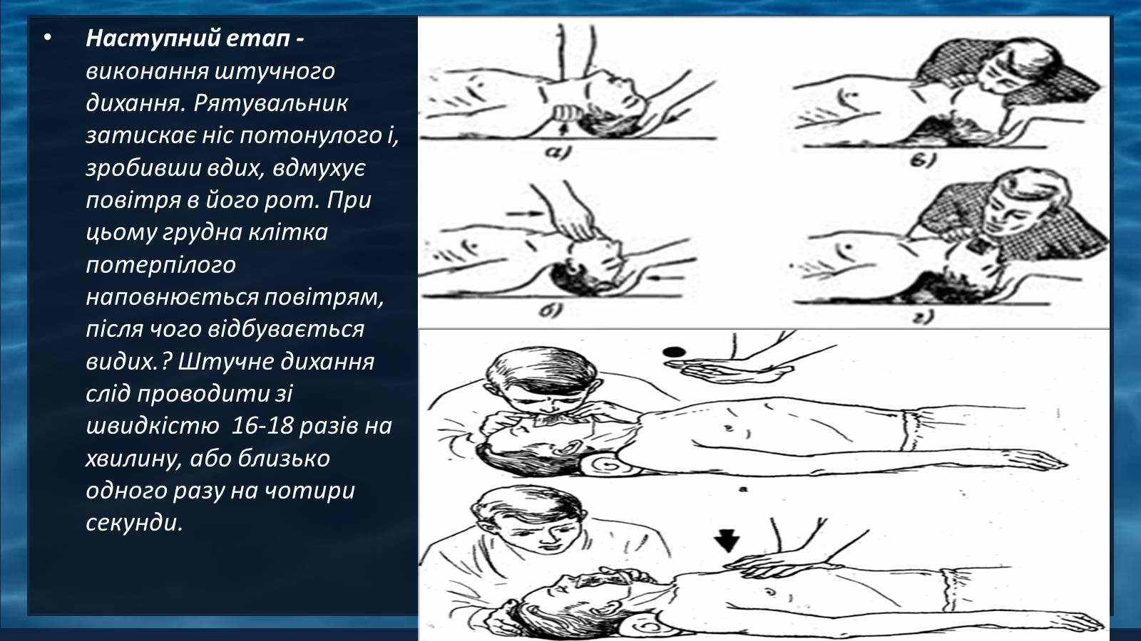 Презентація на тему «Надання першої допомоги при утопленні» - Слайд #8