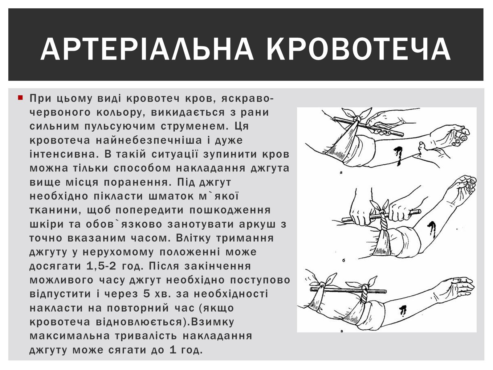 Презентація на тему «Технічна зупинка кровотечі» - Слайд #5