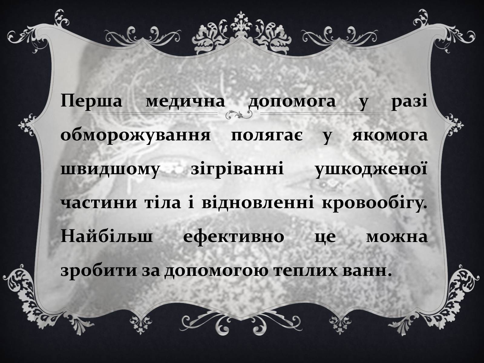 Презентація на тему «Обмороження» (варіант 1) - Слайд #16