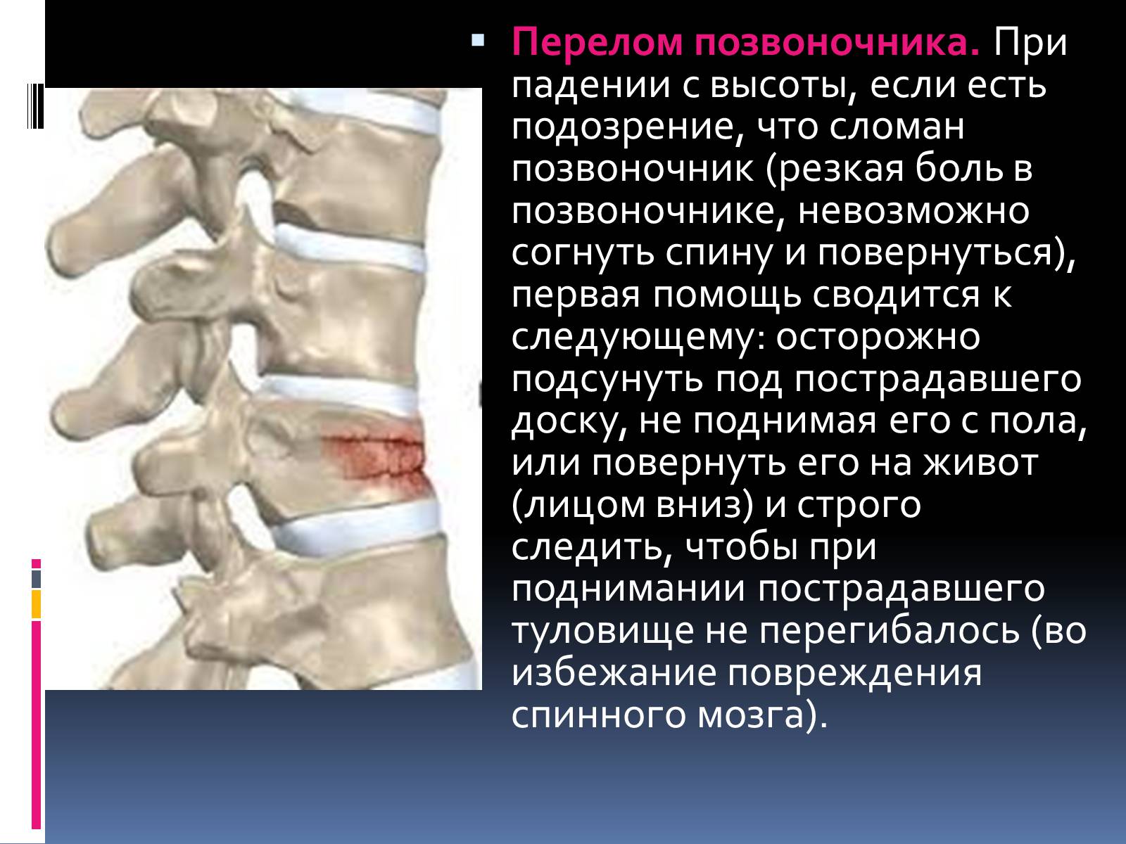 Презентація на тему «Первая помощь при переломах» (варіант 1) - Слайд #4