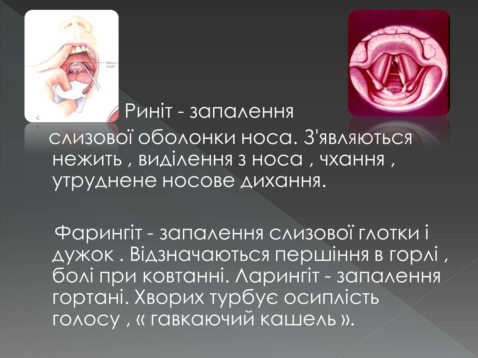 Презентація на тему «Види професійних захворювань органів дихання» - Слайд #13