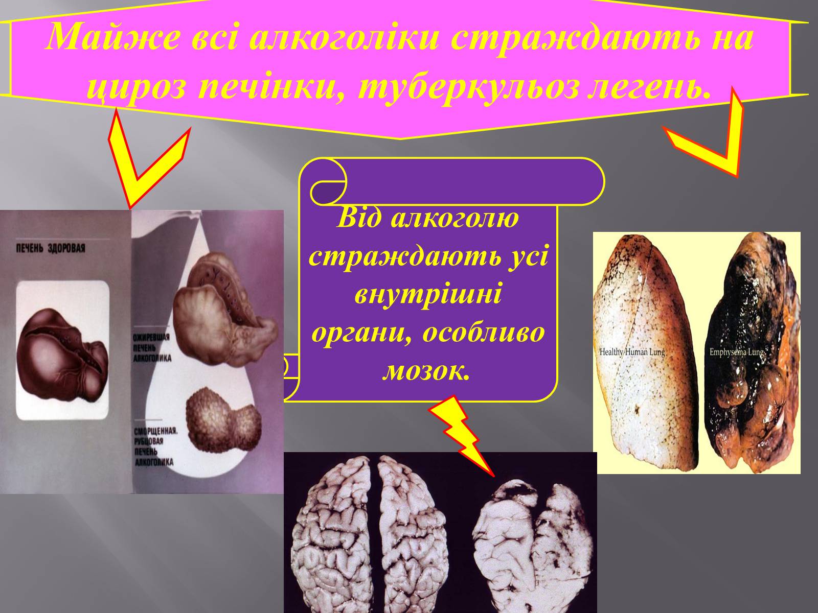 Презентація на тему «Вплив куріння, алкоголю на репродуктивне здоров&#8217;я» - Слайд #13